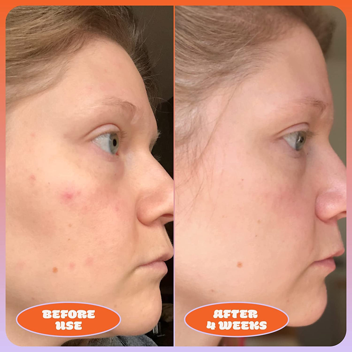 Vitamin C Serum and Blue Tansy Face Oil Duo C9133